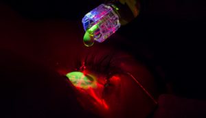 Crosslink - Instituto de Olhos IOP